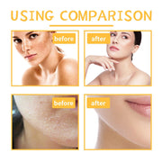 EELHOE Turmeric Body Scrub for Cleansing