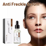 Anti Freckle Serum for Skin Brightening